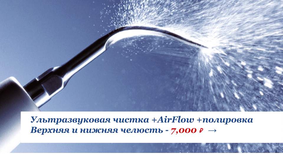 Отбеливание зубов AirFlow